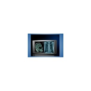 Lumimed LD12A  Illuminator