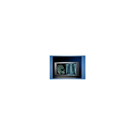 Lumimed LD12A  Illuminator