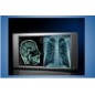 Lumimed LD12A Illuminator Lumimed LD12A Illuminator