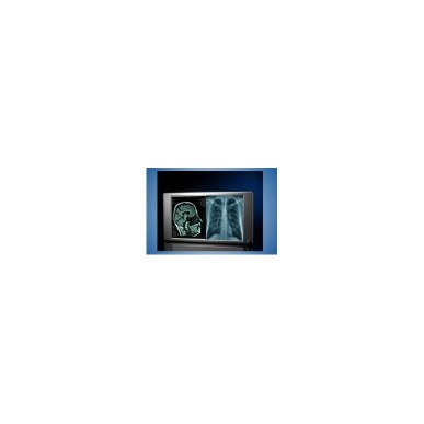 Lumimed LD12A  Illuminator