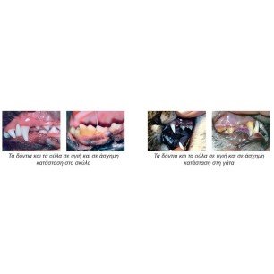 ProDen Dental Finger